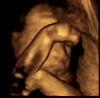 胎儿.jpg